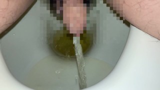 短小包茎ちんぽの黄色いおしっこ