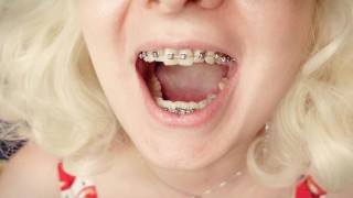 Braces Fetish: mukbang video.