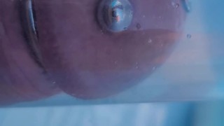 Pool pumping with wand in urethra. 