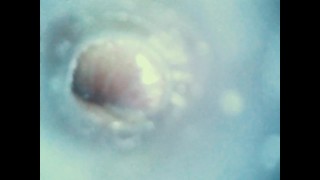 Internal views - Endoscope inside ass , cock , mouth - endoscope anal insertion, urethral insertion