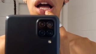 03 video: me quitaron las 4 muelas del juicio :s