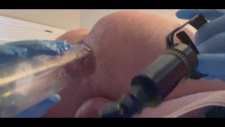 Pumping And Fucking Giant Anal Gape 👻 Swollen asshole pumped and fucked!! Big Dildo.