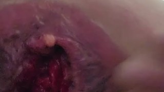 Stretching ass till gap