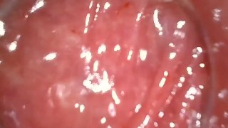 久しぶりにアナル　内視鏡してみたよ