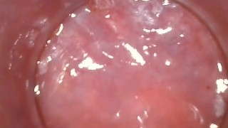 久しぶりにアナル　内視鏡してみたよ