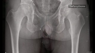 More than skin deep - an x-ray view of my dick!!
