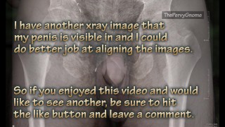 More than skin deep - an x-ray view of my dick!!