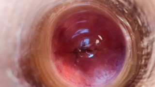 30. My lucky ass. Peniscope