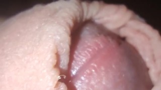 Foreskin