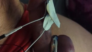 Metal ring estim