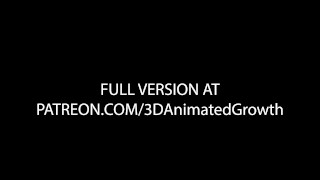 Hospital Growth Teaser