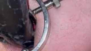 my new speculum opens my hungry ass! this long dildo made my prolapse fart