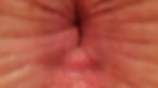 Zoom Into Asshole