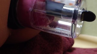 アナル吸引　アナルローズ拡張2