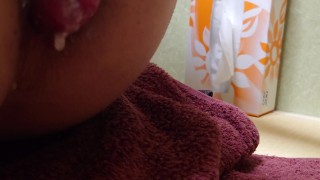 アナル吸引　アナルローズ拡張2