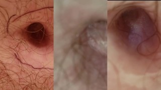 3 Extreme Closeups and Zooms of Belly Button in Multi Cam