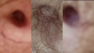 3 Extreme Closeups and Zooms of Belly Button in Multi Cam