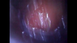 Deep look inside cum filled ass with endoscope