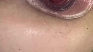 A LOOK INSIDE MY ASS HOLE