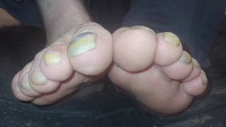 Toenails have gotten long and ugly