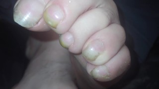 Toenails have gotten long and ugly