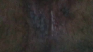 Culo peludo