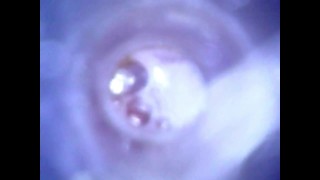 View inside cock while jerking and cumshot ( camera inside dick )