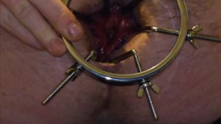 Anal traing with dialator spreader