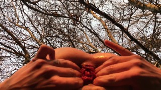 Outdoor twink anal gape - rosebud - wrecked hole