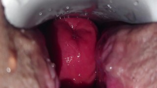 アナル内部　クスコで開いた