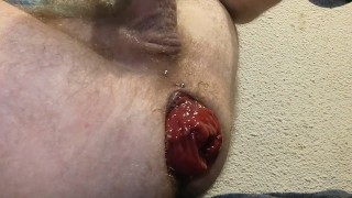 Jerking off with my Prolapse hanging out