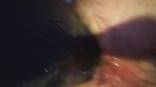 Anal destroy