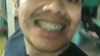 HOMBRE JOVEN Y GUAPO MOSTRANDO SUS BRACKETS Y SU SEXOCIDAD 🤔🙃