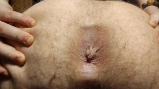 Hole Spreading & Fart Compilation 1 (hemorrhoids)