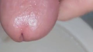 Observation of my urethral opening
