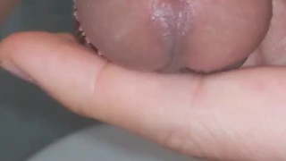 Observation of my urethral opening