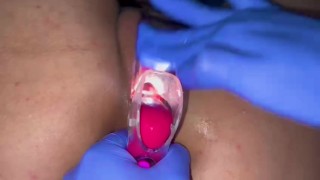 Pussy care gynecologist speculum examination brought me to orgasm fluid examination
