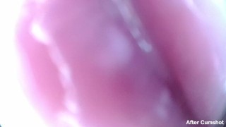 Camera Inside Real Vagina Before & After Creampie - Cervix POV