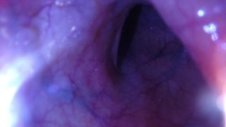 POV - The view staring up my descending colon as I mush you from the outside