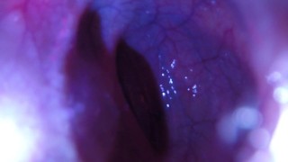 POV - The view staring up my descending colon as I mush you from the outside