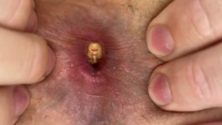 Letting Peter catch a quick breath before disappearing