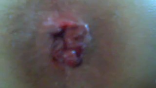 Masturbe (24) with one testicle