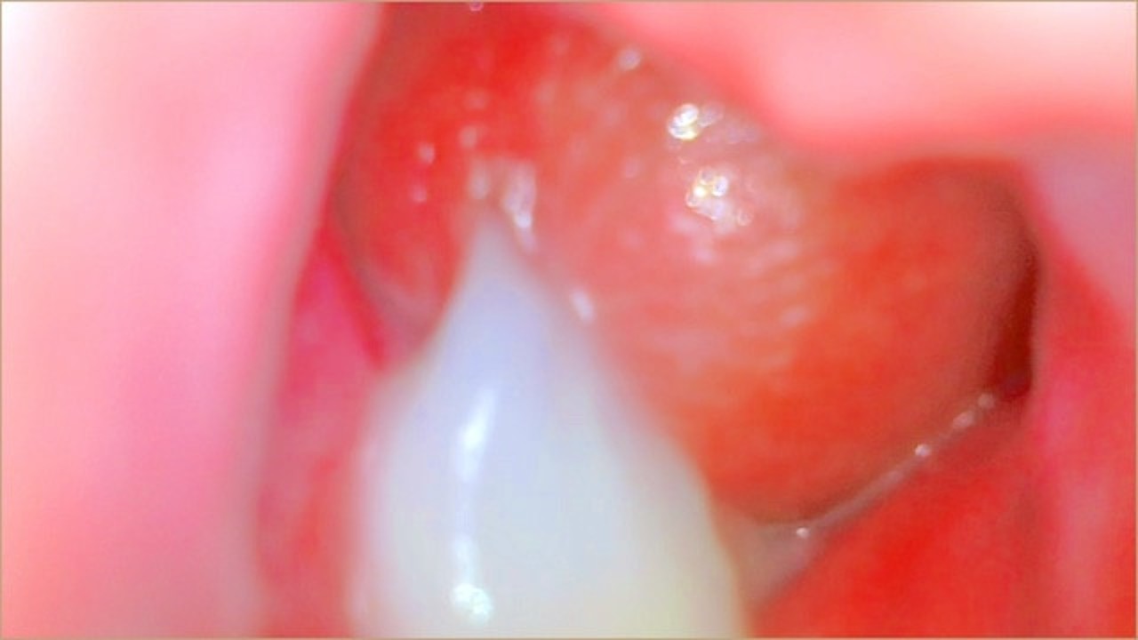 Qin va anusdagi sperma porno fotosuratlari