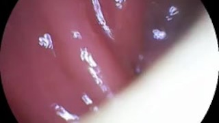 Have a look inside my ass