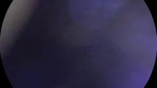 Have a look inside my ass