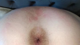 Mon anus ouvert