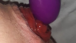 Anal prolaspe fucking whit vibrator