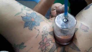 Anal pump left on my ass for too long