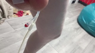 1.5 литра физраствора в яйцах