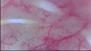 Camera Inside Ass, 9 Throbbing Pulsing Anal Orgasms, Live Stethoscope Heartbeat - Full Clip